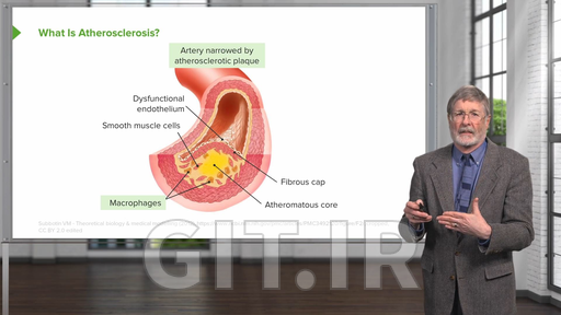 Atherosclerosis