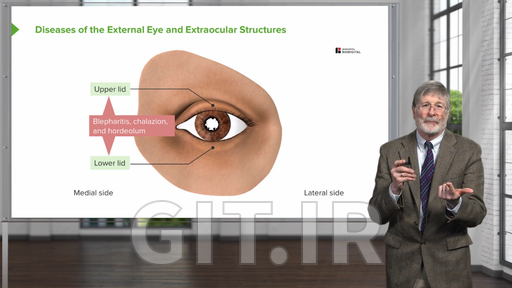 External Eye Diseases