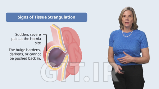 Management of Gastrointestinal System Disorders in the Older Adult