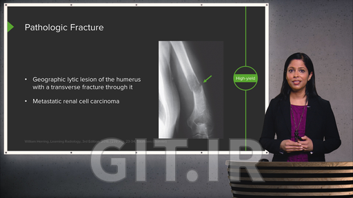 Musculoskeletal Radiology