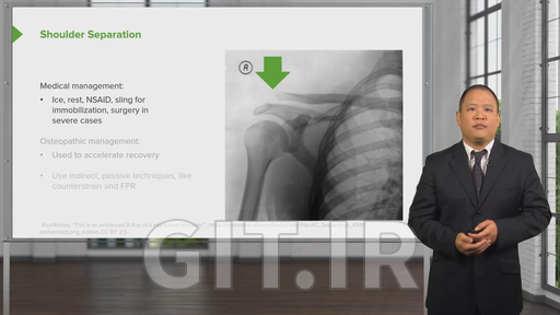 Osteopathic Diagnosis of the Shoulder Region