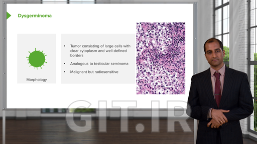 Ovarian Diseases