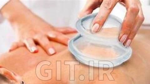 Cupping Massage Therapy