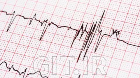 ECG Guide - Mastering ECG One Pulse At a Time