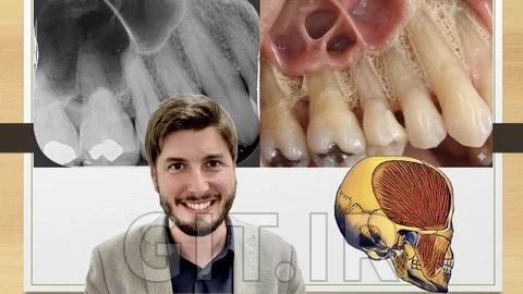 Mastering Head & Neck Anatomy: 2D Radiographs and 3D Images