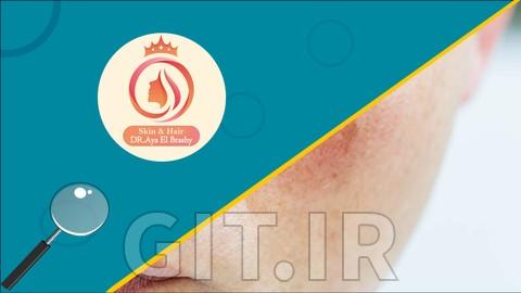 Mastering Sensitive and Damaged Skin: Science to Practice