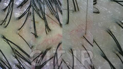 Scalp Type Identification