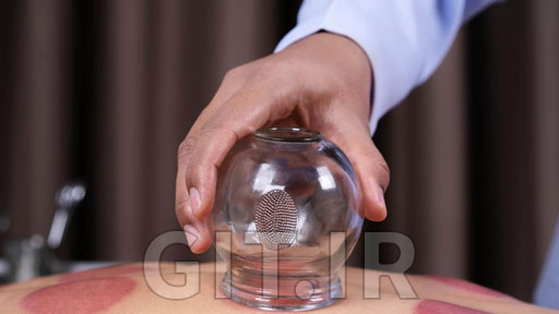 Professional Dry & Korean Cupping Therapy Course