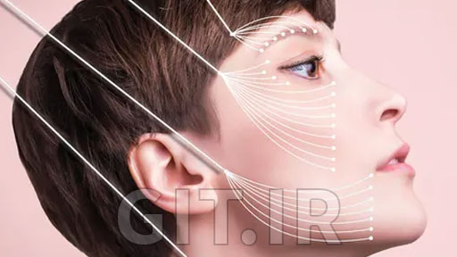 Facial Thread lifting. Simple beginner threads